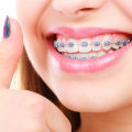 The Benefits of Orthodontics and How to Choose the Right Orthodontic Appliances